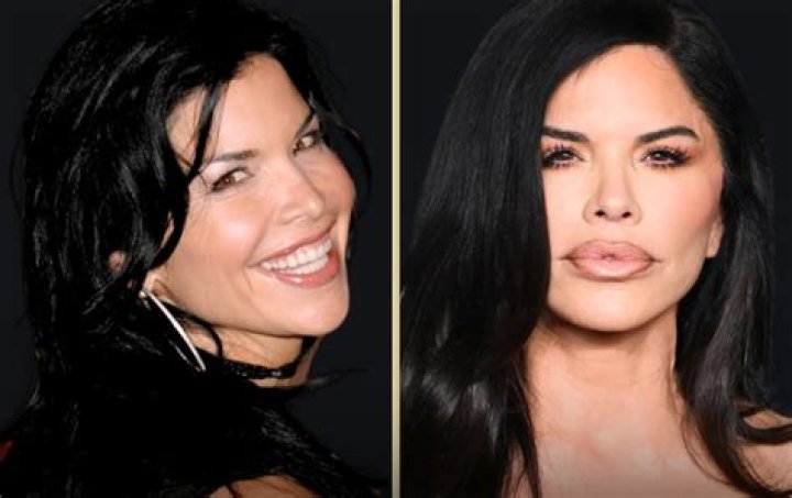 Did Lauren From Jersey Shore Get Plastic Surgery? – Celebrity